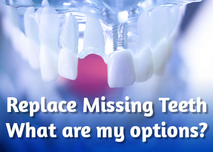 Rochester dentists, Dr. Kenneth Nozik & Dr. John Tumminelli of White Spruce Dental discuss the tooth replacement options available to replace missing teeth and restore your smile.
